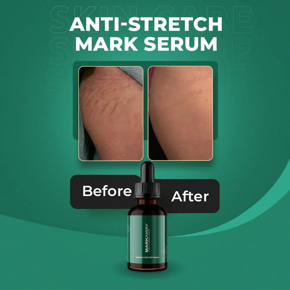 Stretch Mark Serum for Dark Spot Removal & Skin Brightening